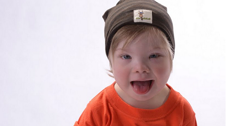 Milán Dubois, niño modelo de 2 años con síndrome de Down que tiene éxito en gran agencia de quien su madre dice: “Es único”