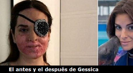 A Gessica Notaro, finalista de Miss Italia, su novio la roció con ácido, ha perdido la visión de un ojo y su cara ha quedado desfigurada: «La fe me salvó y soy más feliz. Me he encomendado a Dios»